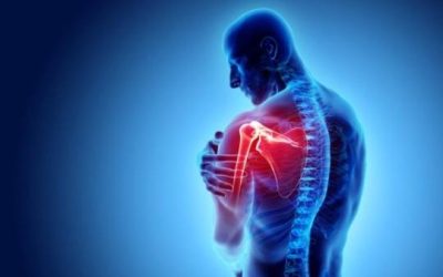Acupuncture – le coude et l&rsquo;épaule
