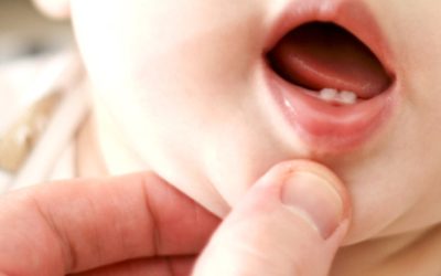 Les dents